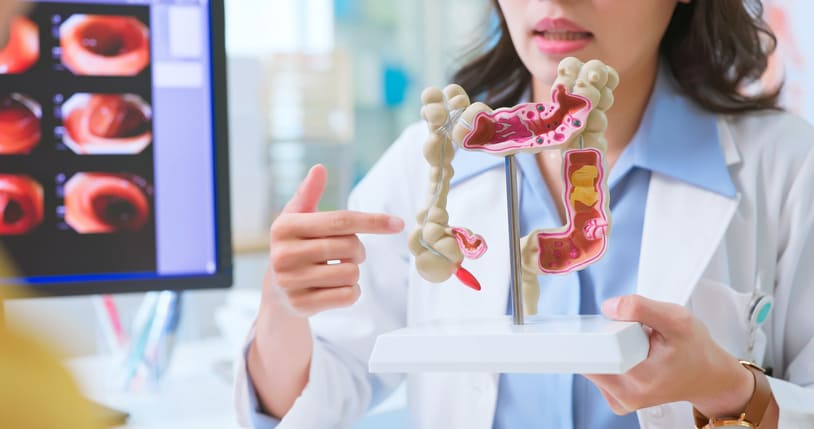 Dicas fáceis para melhorar o funcionamento do intestino Dicas fáceis para melhorar o funcionamento do intestino